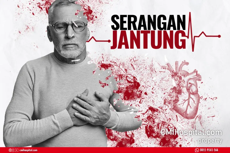 Komplementer Jantung